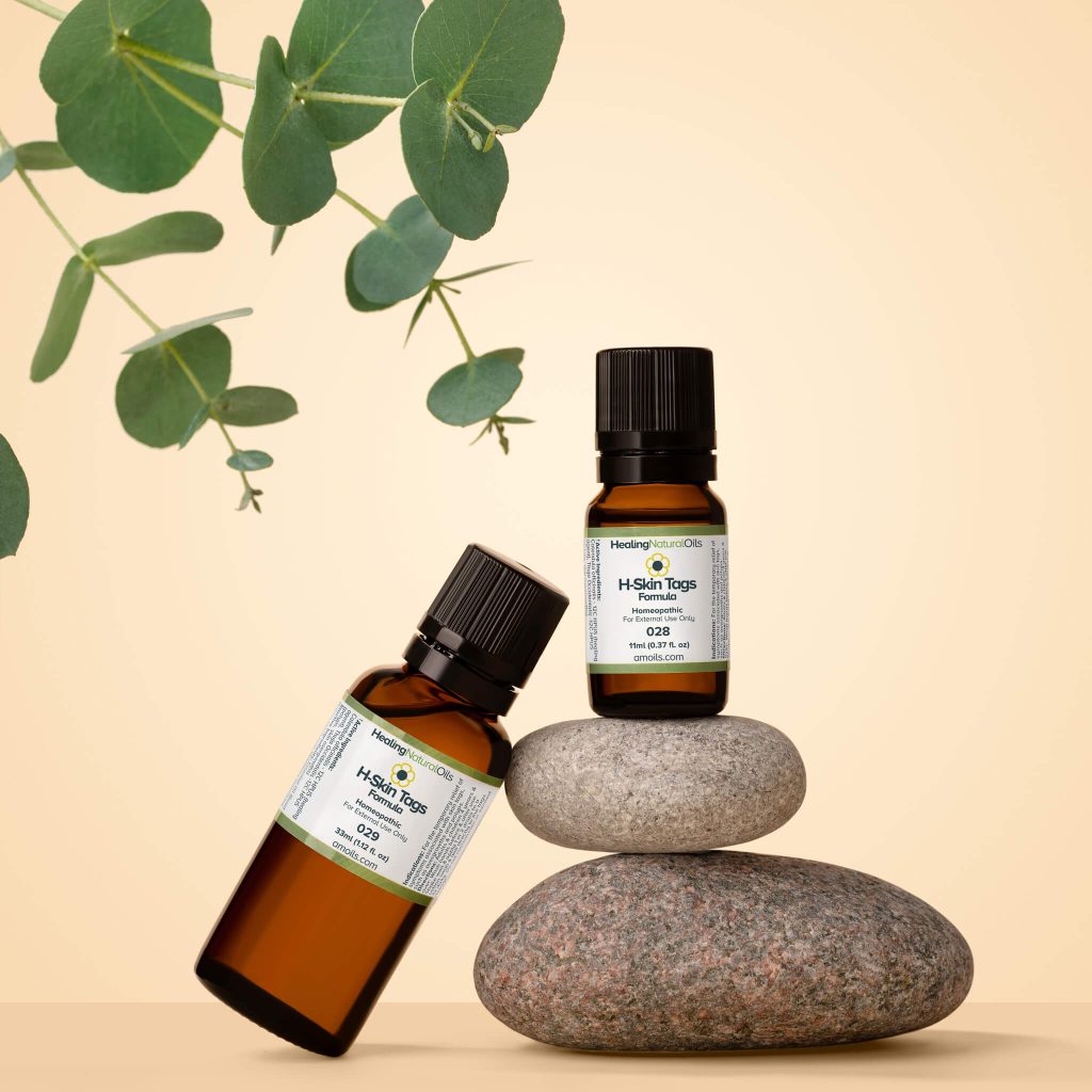 Remove Skin Tags