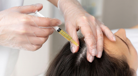 PRP Hair Injections: The Modern Solution for Women’s Hair Regrowth