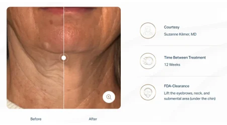 Revolutionary Anti-Aging Treatments That Transform Your Skin